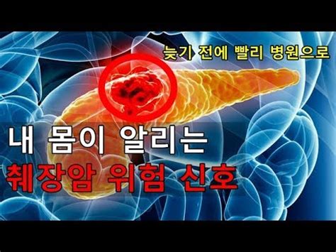 침묵의 병 췌장암의 10가지 전조증상. 췌장암 초기증상 - YouTube