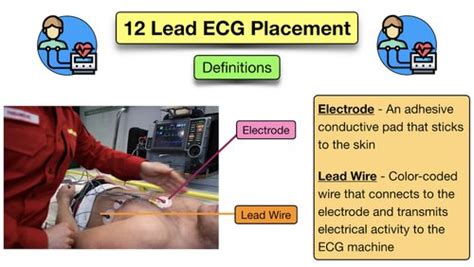 12 Lead Ecg Placement Diagram And Mnemonic For Limb And Precordial