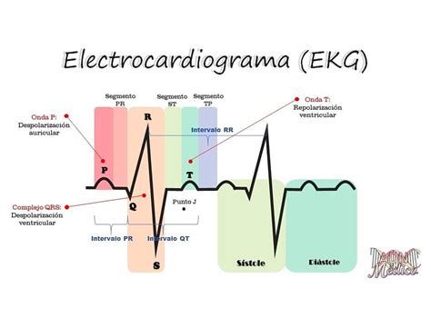 El Electrocardiograma De La Alternancia De Contracciones Durante Un