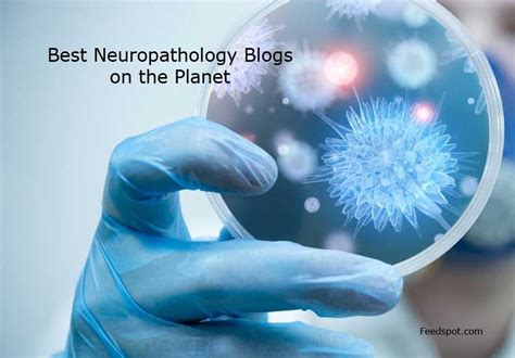 Top 5 Neuropathology Blogs And Websites To Follow In 2021