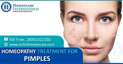 Homeopathy Treatment For Pimples Homeocare International