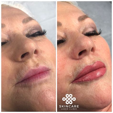 Lip Tattooing | Tattoo Lips Permanent Makeup | Cosmetic Tattoo Victoria