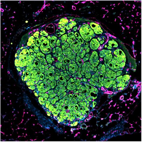 Engineered Human Liver Tissue Grows In Mice The