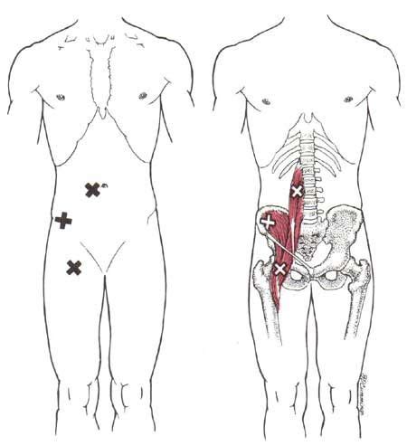 What are the movements are the knee joi… 74 terms. Iliopsoas Trigger Point | Trigger points, Psoas release, Trigger point therapy