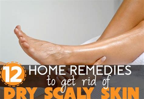 Though dry scaly skin on legs is regarded as a cosmetic concern in some cases even eczema results in this skin disorder. How to Get Rid of Dry Scaly Skin on Legs - 12 Home Remedies