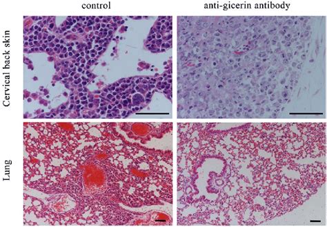 Histopathology Of The Tumor Mass On The Cervical Back Skin Of Nude Mice