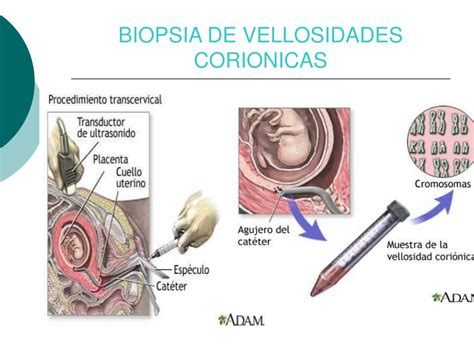Simple Science: How to Make a Volcano with Kids