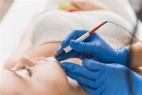 You've probably come across a. During the treatment | Electrolysis Hair Removal & Skin Care