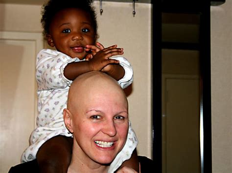 Jenna Benn Bald And Beautiful Cancer Patients Inspiring Stories