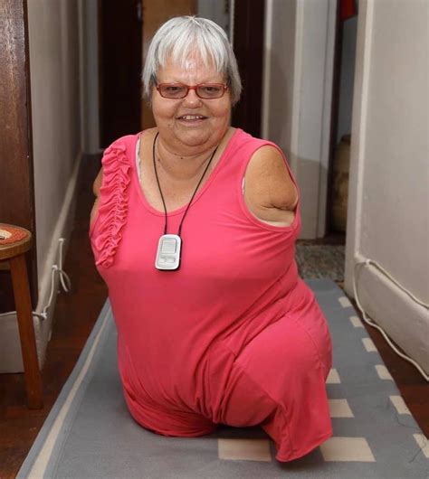 monica gerhard was born without legs and arms but still lives a full life