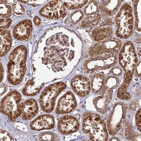 ‎شباب رياضي بلوزداد تأسس يوم 15 جويلية 1962 تحصل الفريق على 18 لقب حتى الآن و. CRBN Antibody (PA5-61122)