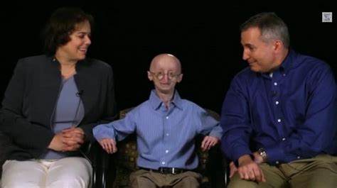 Rest In Peace Sam Berns The Real Life Benjamin Button Dies At 17 [video] Ibtimes India