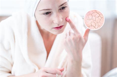 6 Ways To Help Fix Dehydrated Skin Dot Com Women