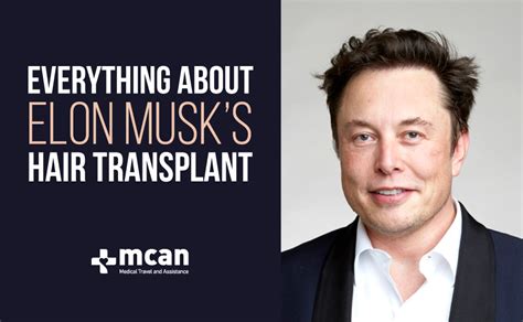 Everything About Elon Musk Hair Transplant 2022