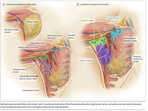 Knowing how many are involved can help doctors make treatment. Regional advanced reoccurrence left clavicle lymph node ...