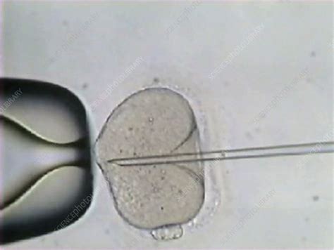 Sperm Injection Into An Egg In Ivf Stock Video Clip K0010804