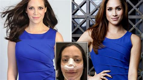 Meghan Markle Fan Spends 35k On Botox Plastic Surgery To Look Like Duchess Au