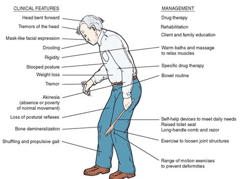 Frontal Lobe Dementia Posture