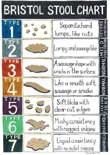 Great Bristol Stool Chart Printable In The Year 2023 Check It Out Now