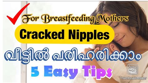 Cracked Nipples Home Remedies After Delivery Priyas Magic World