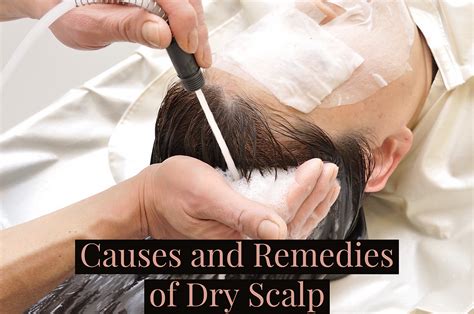 Causes And Remedies Of Dry Scalp