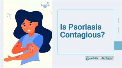 Is Psoriasis Contagious Is Psoriasis Hereditary Get Answers Here