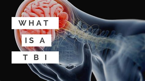 What Is A Tbi Youtube