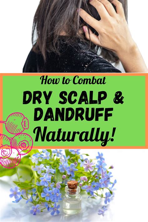 How To Combat Dry Scalp And Dandruff Naturally Home Remedies For
