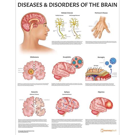 Diseases And Disorders Of The Brain Poster Brain Disorders Chart