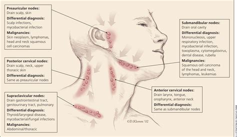 Unexplained Lymphadenopathy Evaluation And Differential Diagnosis Aafp