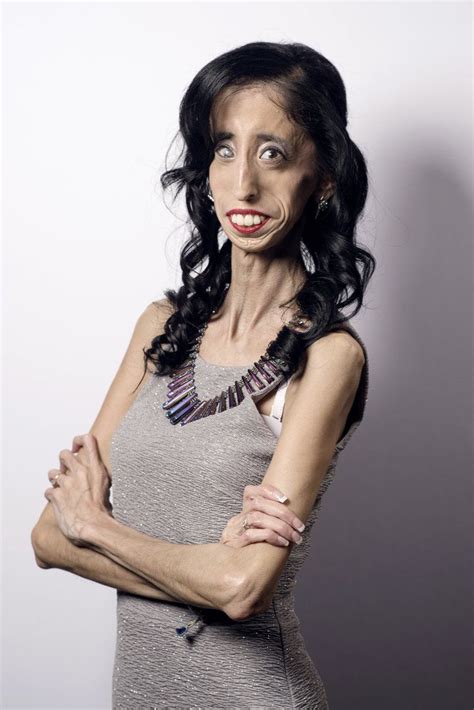 How Being Called The World S Ugliest Woman Transformed Her Life Lizzie Vel Squez Women