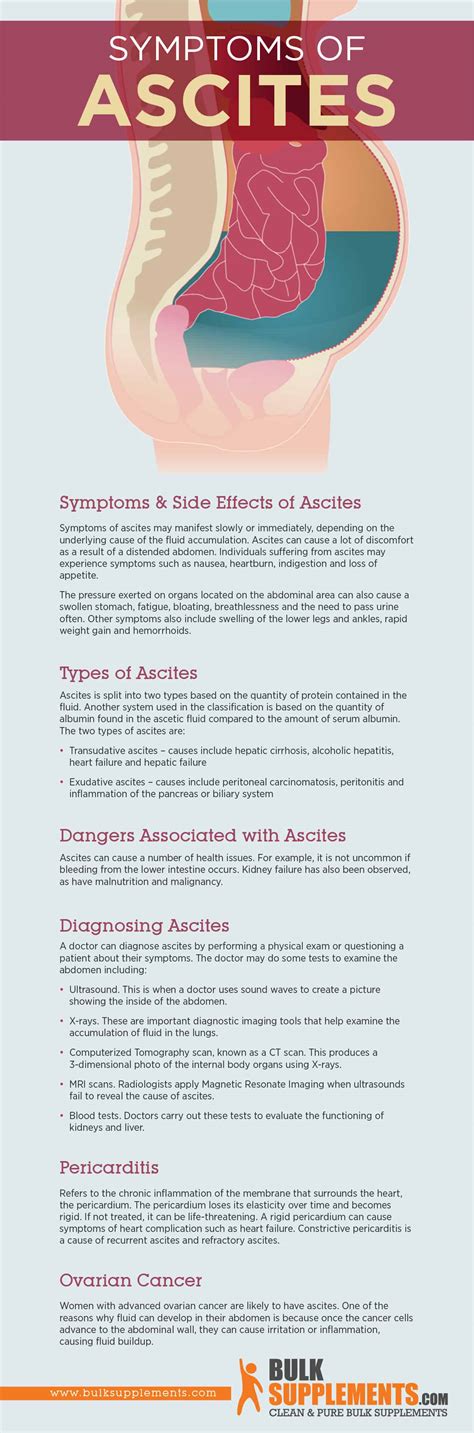Ascites Symptoms Causes And Treatment By James Denlinger