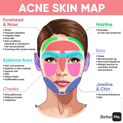 34 Acne Face Map 