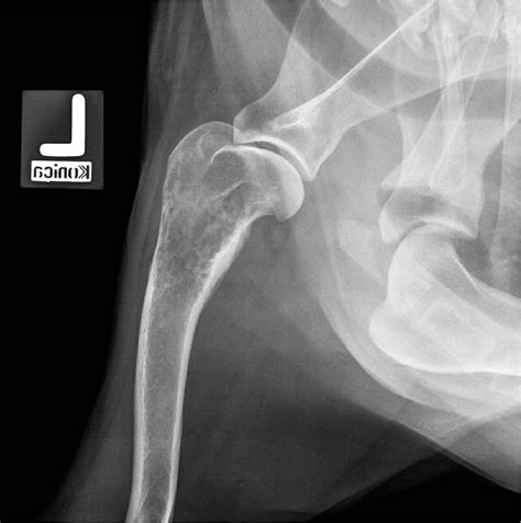 Dog Bone Cancer X Ray Pictures Cancerwalls