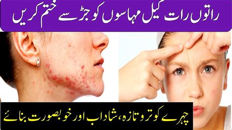Benefits of using lemon juice and honey. Acne Scars Removal - How To Get Rid of Acne Scars With ...