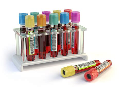 What are the different types of health insurance? Blood Tests | Wellness Perth Natural Medicine