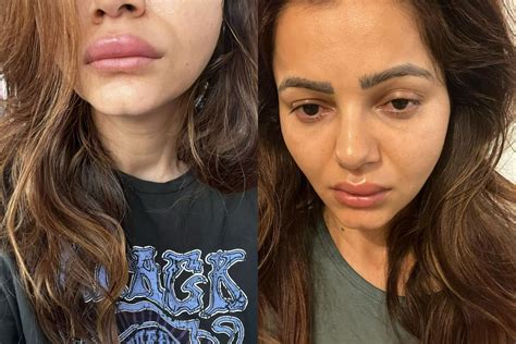 rubina dilaik shares pics of her swollen face and duck lips fans say we are worried for you