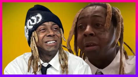 Lil Wayne Swelling Face Caused By Kidney Failure Fans Are Concerned