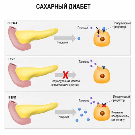Диабет 1 типа лечение диетой