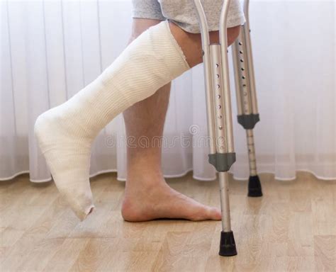 Close Up Of Man Leg In Plaster Cast Using Crutches While Walking Stock