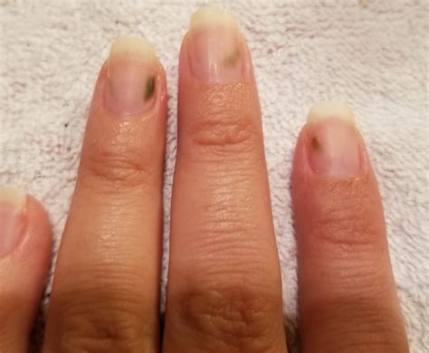 This is because the feet are the fungi that cause the development of nail fungus are called dermatophytes, which are microscopic organisms that thrive in warm, moist environments. What are these green spots on my nails?!? - DIYBeautyAtHome