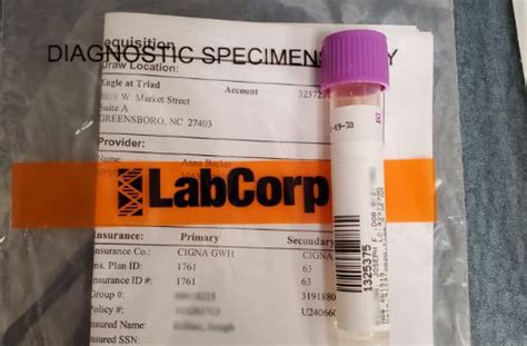 View 20 Labcorp Covid Test Results Basecolor5