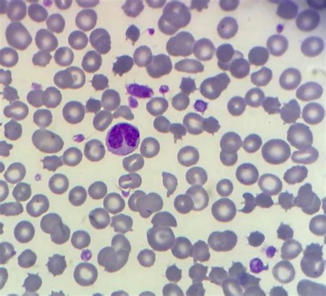Veterinary Hematology Dextervet Macroplatelets Big Platelets