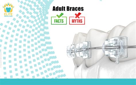 Adult Braces Myths And Facts Elite Dental Care