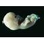 Five Week Old Embryo Photograph By Cnri/science Photo Library