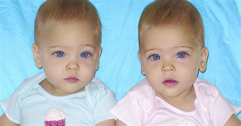Les plus belles jumelles du monde ont désormais 12 ans à quoi