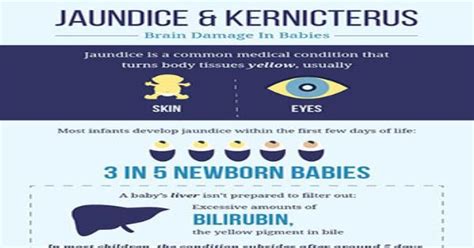 Jaundice And Kernicterus Brain Damage In Babies Infographic
