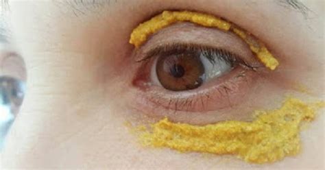 The Healthy Tips She Started Applying Turmeric Around Her Eyes 10