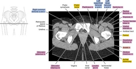 Pelvic Muscles Ct Anatomy Vrogue Co