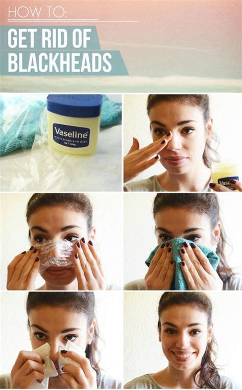 Hop in the shower, rub on some shaving cream, grab a disposable razor, and have at it. How to Get Rid of Blackheads Permanently